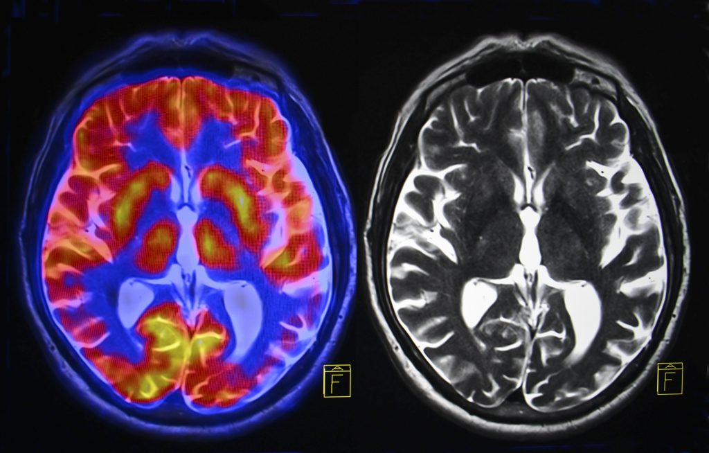 Medical Physics mri brain scan
